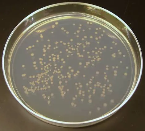Agar Plates